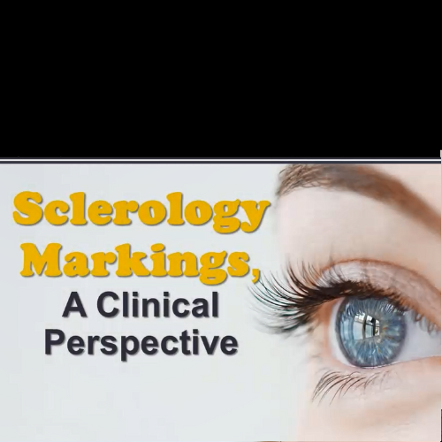 Sclerology Markings-A Clinical Perspective