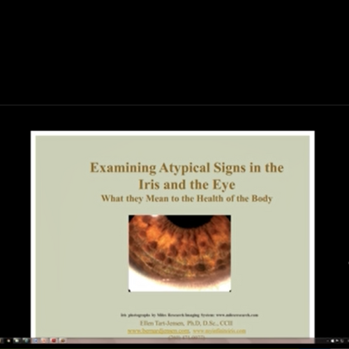 Examining Atypical Signs in the Iris of the Eye