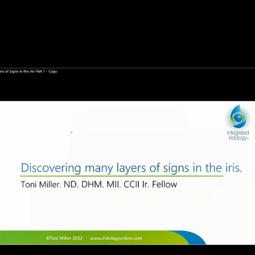 Discovering the Many Layers of Signs in the Iris-Part 1