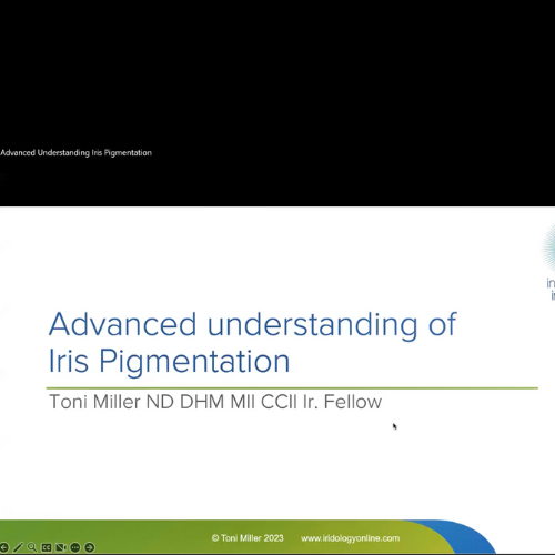 Advanced Understanding Iris Pigmentation