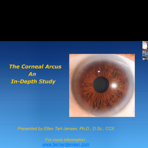 A Corneal Arcus – An In Depth Study