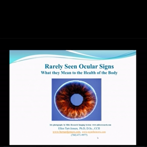 Rare Ocular Signs