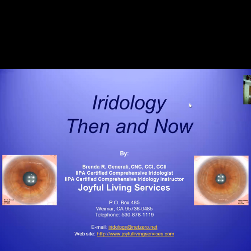 Iridology-Then and Now