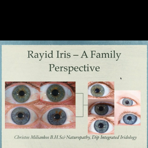 Rayid Iris Anaylsis and Birth Order-Part 2